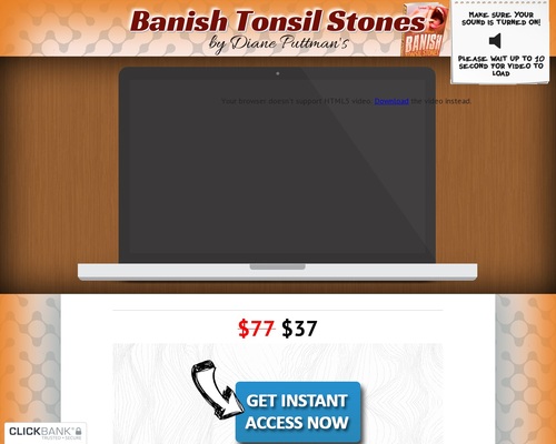Tonsil Stones! *up To $22/sale* New Vsl!