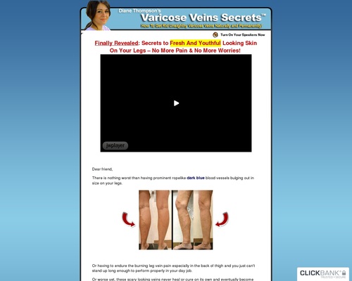 Get Rid Varicose Veins Naturally ** Hot Niche - 70%/sale