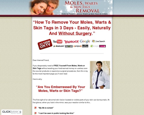 Moles, Warts & Skin Tags Removal ~ 2020 Update